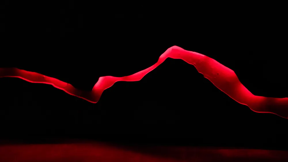 Red Ribbon